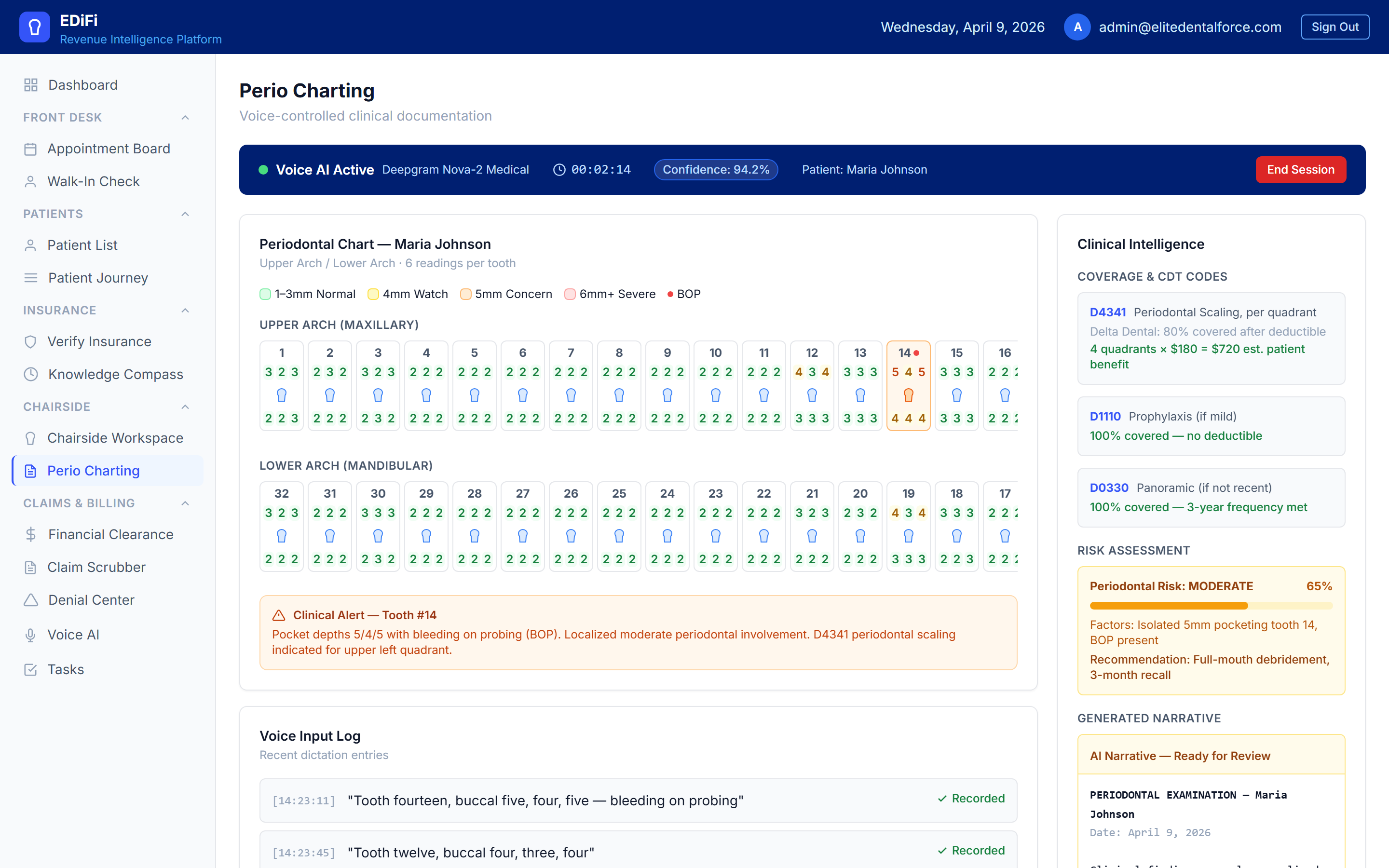 EDiFi Perio Charting AI — voice-controlled clinical documentation with AI risk assessment, CDT coding, and auto-generated clinical narrative